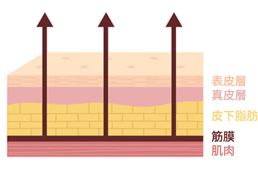 ミントスレッドリフトが皮膚筋膜層(SMAS)から深く引き上げる過程を説明する皮膚層イラスト